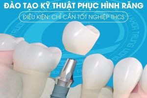 THU NHẬP “KHỦNG” VỚI NGÀNH KỸ THUẬT PHỤC HÌNH RĂNG