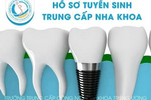 Cơ hội và Thách thức của ngành Kỹ thuật phục hình răng